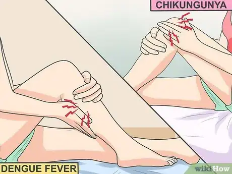 Image titled Ease Muscle Pain from Chikungunya Step 3