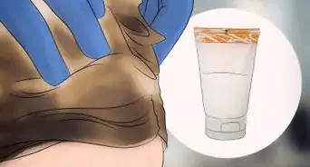 Treat Dandruff in Children