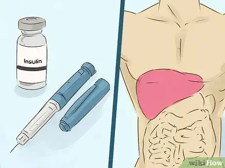 Image titled Diagnose Liver Cancer Step 15