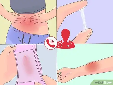 Image titled Use Spermicides Step 12