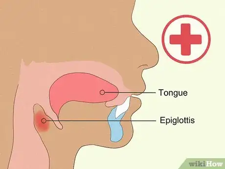 Image titled Soothe a Burnt Tongue Step 8