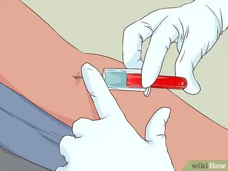 Image titled Diagnose Multiple Myeloma Step 7