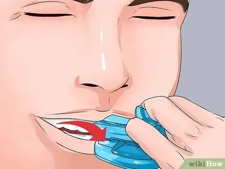Image titled Stop Snoring by Using an Anti Snoring Mouthpiece Step 15