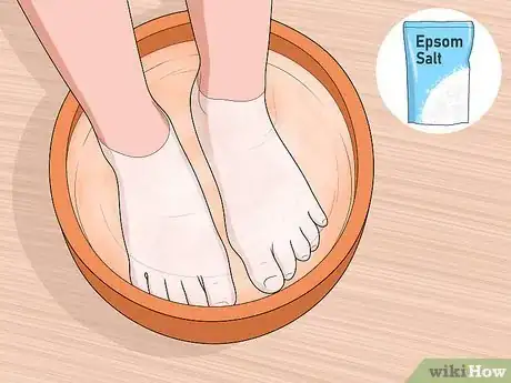 Image titled Treat Bunions Naturally Step 4