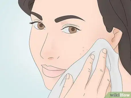 Image titled Wash an Acne Prone Face Step 6