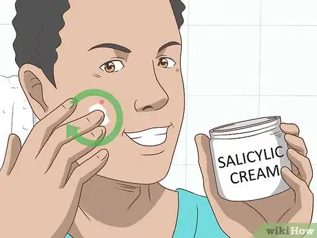 Image titled Get Rid of a Pimple Step 4