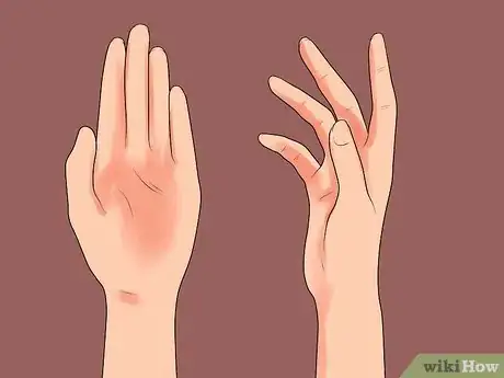 Image titled Identify Female Heart Attack Symptoms Step 13