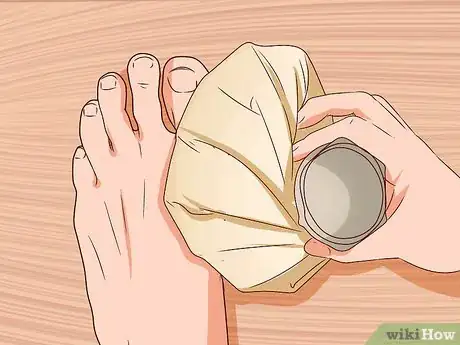 Image titled Relieve Bunions Step 5