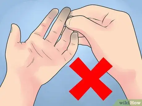 Image titled Heal Skin Damage from Frostbite Step 6