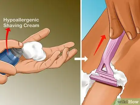 Image titled Prevent Ingrown Hairs on the Pubic Area Step 2