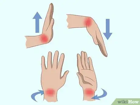 Image titled Diagnose Arthritis Step 7