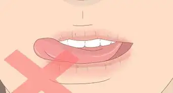 Take Care of Your Skin While on Accutane