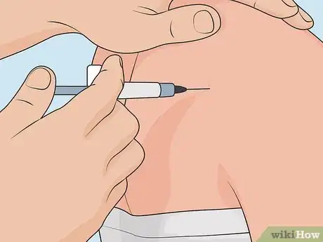 Image titled Control Psoriasis Step 19