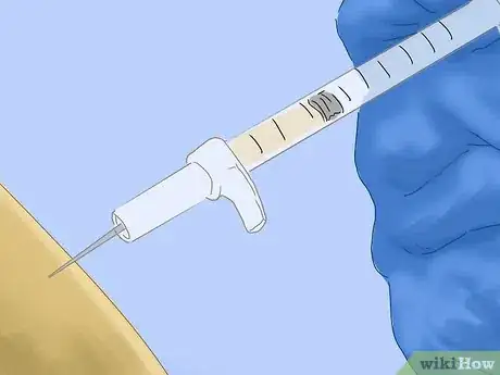 Image titled Get Rid of Knee Pain from Running Step 12