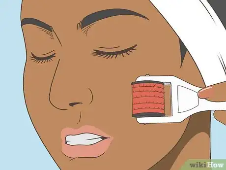 Image titled Buy a Dermaroller Step 12