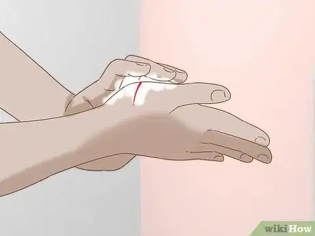 Image titled Heal Cuts Step 5