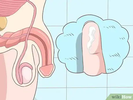 Image titled Recognize Chlamydia Symptoms (for Men) Step 1