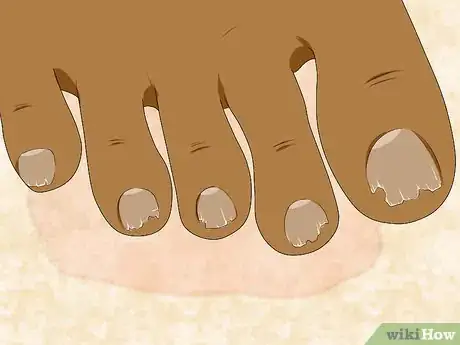 Image titled Condition and Strengthen Nails Using Kitchen Ingredients Step 2