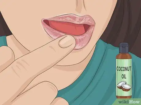 Image titled Remove Liquid Lipstick Step 5