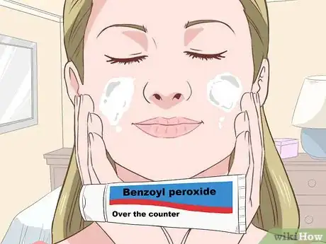 Image titled Stop Acne Reinfection Step 6