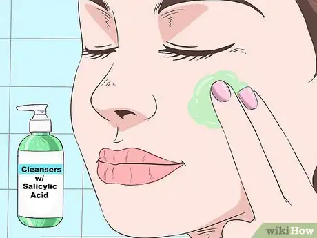 Image titled Stop Acne Reinfection Step 5