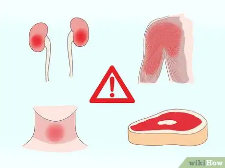 Image titled Bring Down High Creatinine Levels Step 4