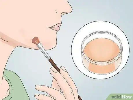 Image titled Cover Inflamed Pimples Step 5