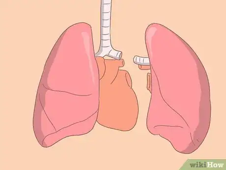 Image titled Treat Cystic Fibrosis Step 14