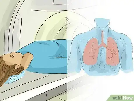 Image titled Test for Tuberculosis Step 16