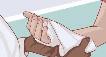 Know If Your Knuckle Is Broken