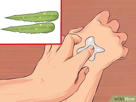 Image titled Treat Acne Scars with Aloe Vera Step 5