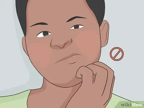 Image titled Clear Up Rosacea Without Medication Step 6