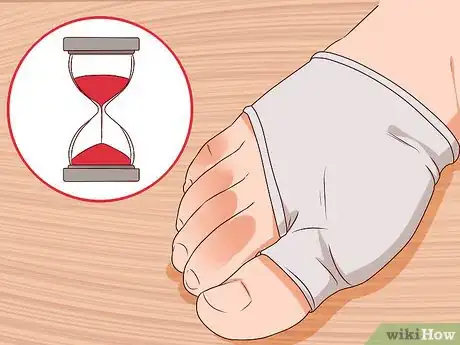 Image titled Relieve Bunions Step 13