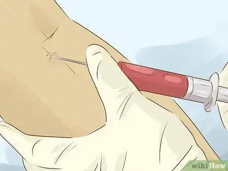 Image titled Get Tested for Allergies Step 12