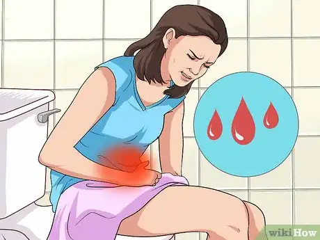 Image titled Identify Signs of Secondary Dysmenorrhea Step 7