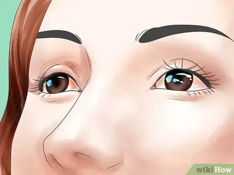 Image titled Diagnose Measles Step 5