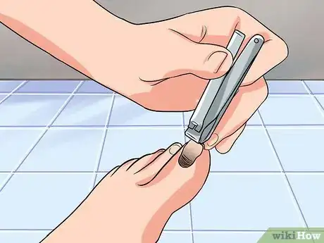 Image titled Remove a Dead Toenail Step 8