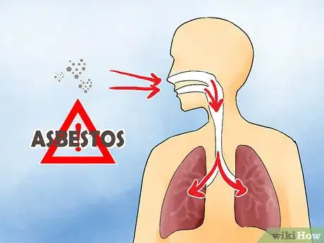 Image titled Determine If You Have Mesothelioma Step 01