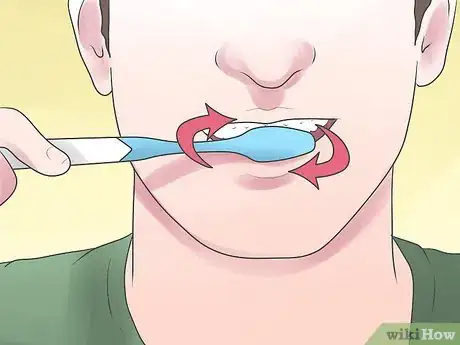 Image titled Clean Your Teeth After Wisdom Teeth Removal Step 2