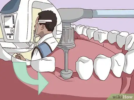 Image titled Replace a Tooth Step 13