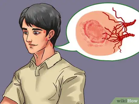 Image titled Stop Helmet Itch Step 8