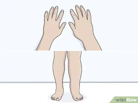 Image titled Identify Lymphedema Step 2