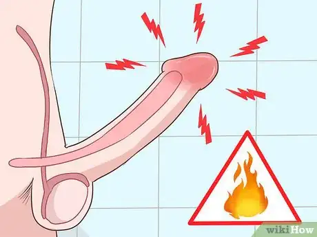 Image titled Recognize Chlamydia Symptoms (for Men) Step 3