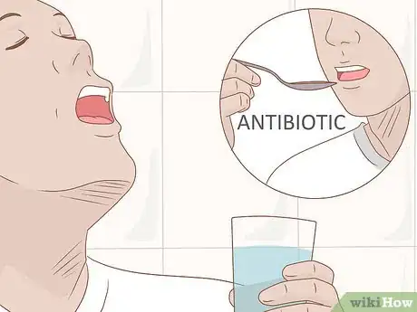Image titled Prevent Oral Thrush Step 7
