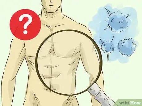 Image titled Care for a Person With Jaundice Step 1