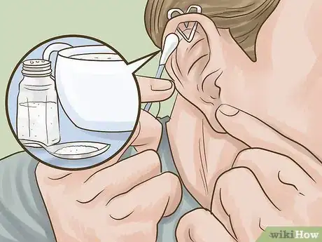 Image titled Get a Heart Cartilage Piercing Step 10