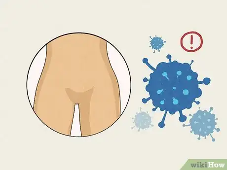 Image titled Deal with Soreness After Sex Step 5