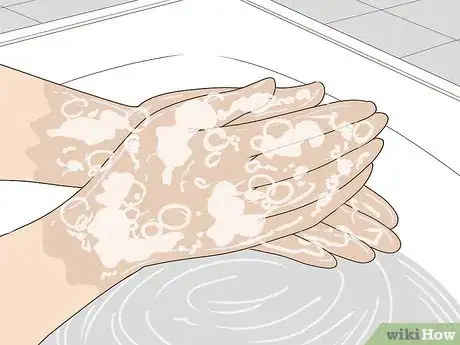 Image titled Plate Bacteria Using Aseptic Technique Step 2