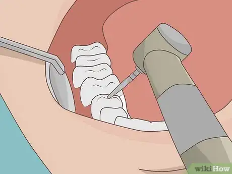 Image titled Prevent a Root Canal Step 13