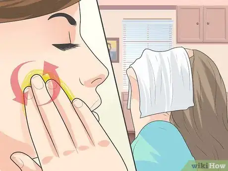 Image titled Treat Cystic Acne Naturally Step 15